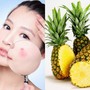 Bí quyết sở hữu làn da căng bóng, mịn màng chỉ nhờ một quả dứa
