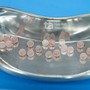 Người đàn ông 34 tuổi viêm dương vật, bác sĩ phát hiện 20 viên thủy tinh dưới da