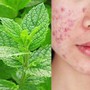 Da mụn nên ăn rau gì cho mát? Mẹo làm đẹp da đơn giản từ các loại rau quen thuộc