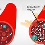 Người đàn ông 30 tuổi tử vong tại bàn làm việc, đường huyết tăng vọt vì bệnh tiểu đường: Bất ngờ từ chế độ ăn