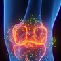 Cảnh báo loại thực phẩm gây nguy cơ tích mỡ vùng đùi và thoái hóa khớp