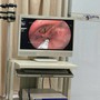 Người đàn ông 56 tuổi bị kiến chui vào thanh quản từ 1 việc không ngờ tới