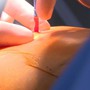 Người đàn ông 72 tuổi bất ngờ phát hiện ung thư phổi giai đoạn sớm từ dấu hiệu nhiều người Việt bỏ qua