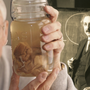 Chuyện gì đã xảy ra với bộ não thiên tài của Albert Einstein sau khi ông qua đời?